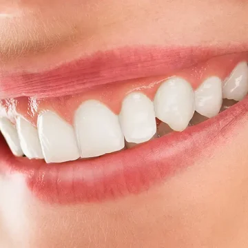 Benefits of a Whiter, Brighter Smile!