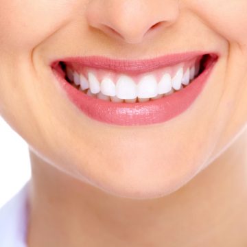 Teeth Whitening Guide: What are the Treatment Options, Procedure, Results?