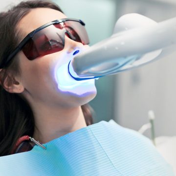 What Does Laser Dentistry Entail?