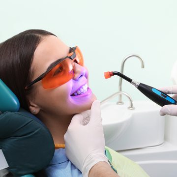 How Long Does Dental Bonding Take to Heal? Do Bonded Teeth Break Easily?