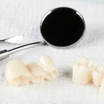 What Are the Signs a Dental Crown Needs Replacement?