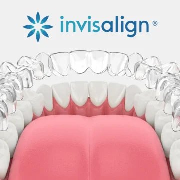 Is Invisalign Right for You? How the Technology Works