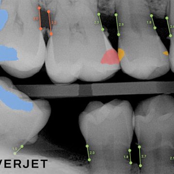 How AI Technology at Petaluma Dental Group Helps You Better Understand Your Health